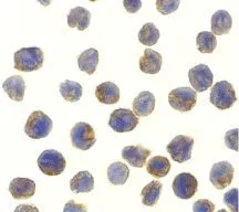 ICC/IF analysis of MOLT4 cells using GTX31658 NAK / TBK1 antibody. Working concentration : 10 microg/ml ICC/IF analysis of MOLT4 cells using GTX31658 NAK / TBK1 antibody. Working concentration : 10 microg/ml