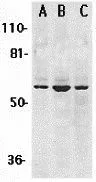 WB analysis of (A) K562, (B) Jurkat, and (C) HL-60 whole cell lysates using GTX31659 Chk2 antibody. Working concentration : 1 microg/ml