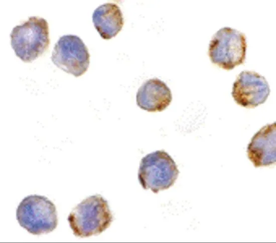 ICC/IF analysis of K562 cells using GTX31662 MTBP antibody. Working concentration : 5 microg/ml ICC/IF analysis of K562 cells using GTX31662 MTBP antibody. Working concentration : 5 microg/ml