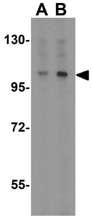 WB analysis of K562 cell lysate using GTX31662 MTBP antibody. Working concentration : (A) 1 and (B) 2 microg/ml