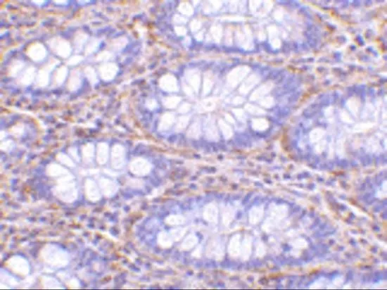 IHC-P analysis of human colon tissue using GTX31673 PAK4 antibody. Working concentration : 10 microg/ml IHC-P analysis of human colon tissue using GTX31673 PAK4 antibody. Working concentration : 10 microg/ml