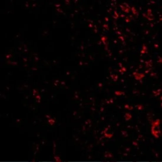 IHC-P analysis of human colon tissue using GTX31673 PAK4 antibody. Working concentration : 20 microg/ml