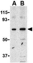 WB analysis of SW480 cell lysate using GTX31673 PAK4 antibody. Working concentration : (A) 1 and (B) 2 microg/ml