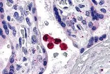 IHC-P analysis of human placenta tissue using GTX31674 TLR4 antibody. Working concentration : 5 microg/ml IHC-P analysis of human placenta tissue using GTX31674 TLR4 antibody. Working concentration : 5 microg/ml