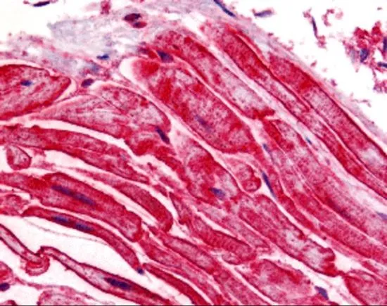 IHC-P analysis of human heart tissue using GTX31679 ALS2CR2 antibody. Working concentration : 5 microg/ml IHC-P analysis of human heart tissue using GTX31679 ALS2CR2 antibody. Working concentration : 5 microg/ml