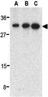 WB analysis of human heart tissue lysate using GTX31679 ALS2CR2 antibody. Working concentration : (A) 0.5, (B) 1, and (C) 2 microg/ml