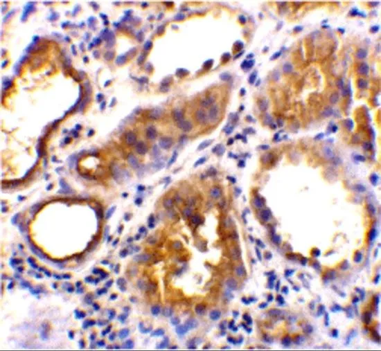 IHC-P analysis of human kidney tissue using GTX31680 ACE2 antibody. Working concentration : 2 microg/ml