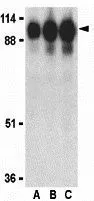 WB analysis of human kidney tissue lysate using GTX31680 ACE2 antibody. Working concentration : (A) 0.5, (B) 1, and (C) 2 microg/ml