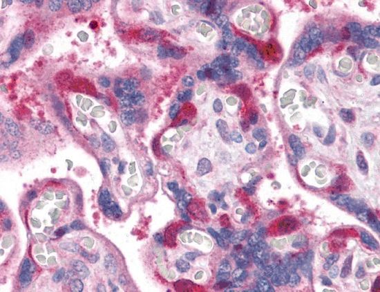 irip antibody irip antibody