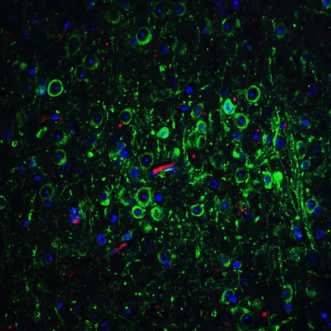 IHC-P analysis of 4% PFA-fixed Mouse Brain Tissue using GTX31686 Bcl-2 antibody. Dilution : 20microg/mL IHC-P analysis of 4% PFA-fixed Mouse Brain Tissue using GTX31686 Bcl-2 antibody. Dilution : 20microg/mL