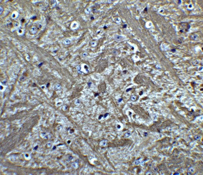 IHC-P analysis of formaldehyde fixed Mouse Brain Tissue using GTX31686 Bcl-2 antibody. Antigen retreival : Heat mediation with a citrate buffer (pH6) Dilution : 5microg/mL