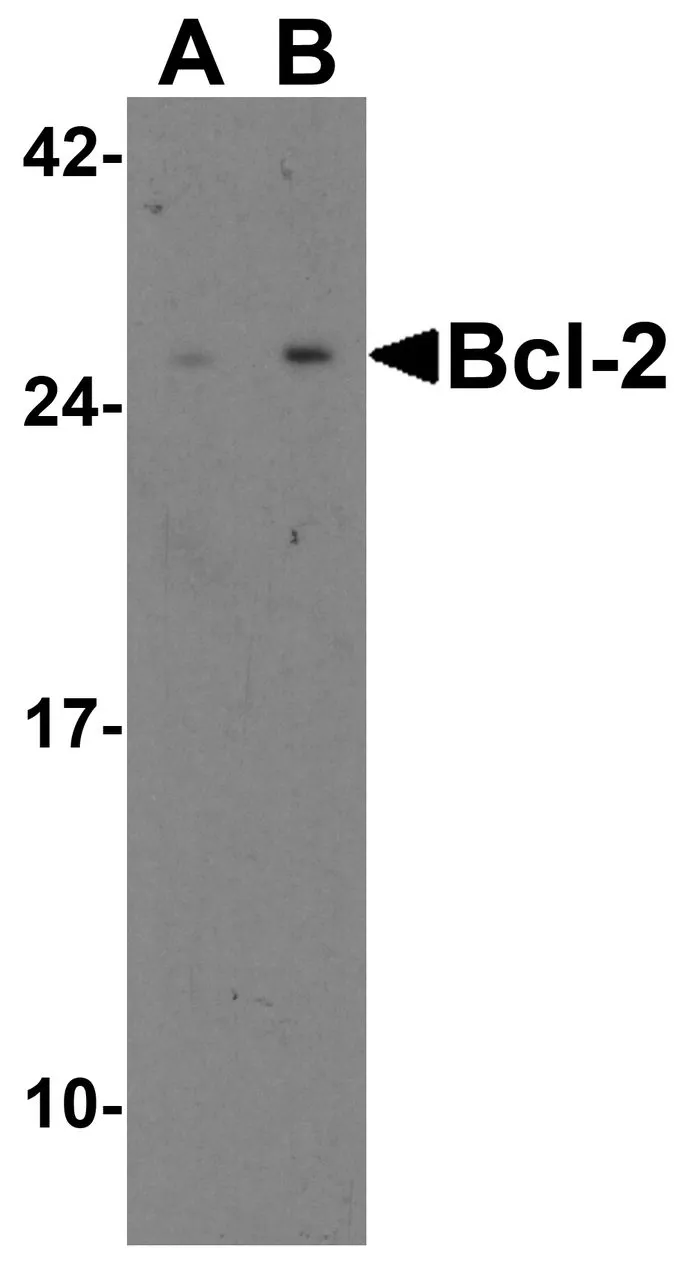 WB analysis of A-20 cell lysate using GTX31686 Bcl-2 antibody.
