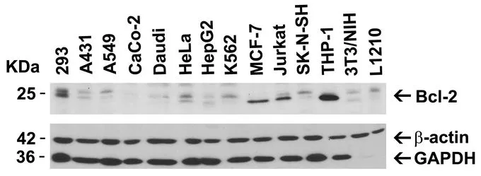 WB analysis of various cell lines using GTX31686 Bcl-2 antibody. Dilution : 2microg/mL Loading : 15microg of lysates per lane