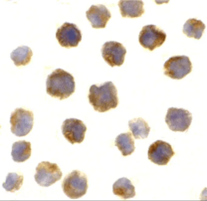 ICC/IF analysis of A-20 cells using GTX31687 Bcl-2 antibody. ICC/IF analysis of A-20 cells using GTX31687 Bcl-2 antibody.