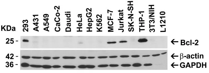 WB analysis of various cell lines using GTX31687 Bcl-2 antibody. Dilution : 2microg/mL Loading : 15microg of lysates per lane