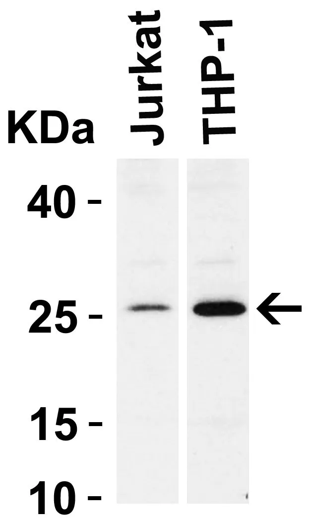 WB analysis of Jurkat and THP-1 cell lysate using GTX31687 Bcl-2 antibody. Dilution : 2microg/mL Loading : 15microg of lysates per lane