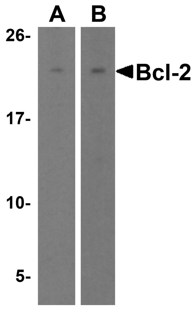 WB analysis of various samples using GTX31687 Bcl-2 antibody. Lane 1 : Daudi cell lysate Lane 2 : A-20 cell lysate Dilution : 2microg/mL Loading : 15microg of lysates per lane