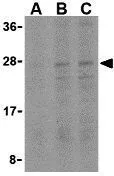 WB analysis of A549 cell lysate using GTX31690 Bid antibody. Working concentration : (A) 0.5, (B) 1, and (C) 2 microg/ml WB analysis of A549 cell lysate using GTX31690 Bid antibody. Working concentration : (A) 0.5, (B) 1, and (C) 2 microg/ml