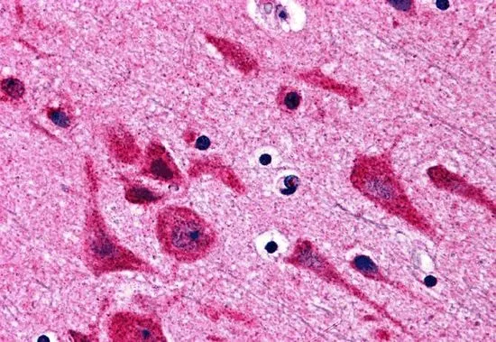 IHC-P analysis of human brain tissue using GTX31692 TAB2 antibody. Working concentration : 5 microg/ml IHC-P analysis of human brain tissue using GTX31692 TAB2 antibody. Working concentration : 5 microg/ml