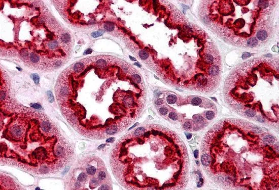 IHC-P analysis of human kidney tissue using GTX31693 TAB3 antibody. Working concentration : 5 microg/ml IHC-P analysis of human kidney tissue using GTX31693 TAB3 antibody. Working concentration : 5 microg/ml