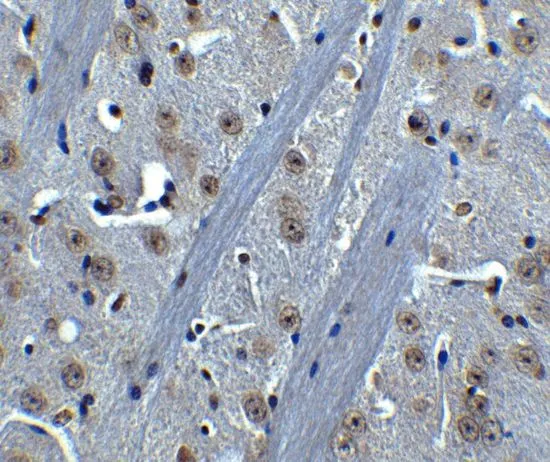 IHC-P analysis of mouse brain tissue using GTX31694 BTK antibody. Working concentration : 5 microg/ml IHC-P analysis of mouse brain tissue using GTX31694 BTK antibody. Working concentration : 5 microg/ml