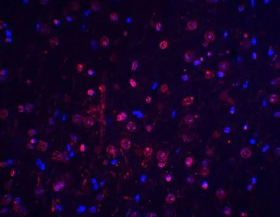 IHC-P analysis of mouse brain tissue using GTX31694 BTK antibody. Working concentration : 20 microg/ml