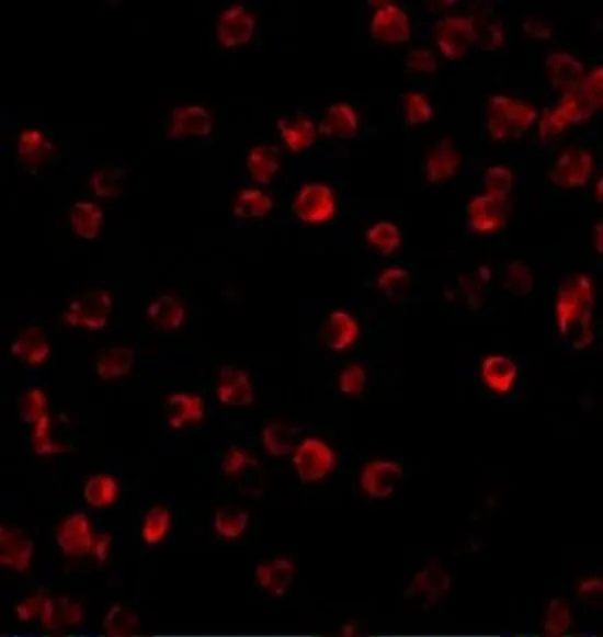 ICC/IF analysis of Daudi cells using GTX31694 BTK antibody. Working concentration : 10 microg/ml