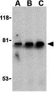 WB analysis of U937 cell lysate using GTX31694 BTK antibody. Working concentration : (A) 0.5, (B) 1, and (C) 2 microg/ml