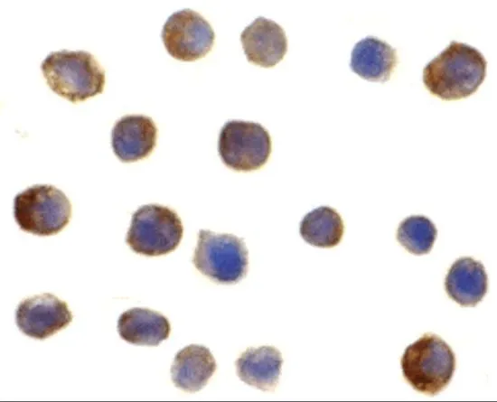 ICC/IF analysis of Ramos cells using GTX31695 IRF3 antibody. Working concentration : 2 microg/ml