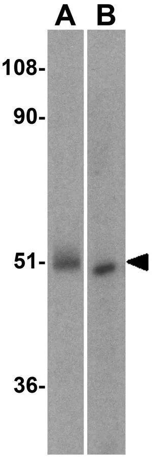 WB analysis of (A) human kidney and (B) rat kidney lysate using GTX31695 IRF3 antibody. Working concentration : 1 microg/ml