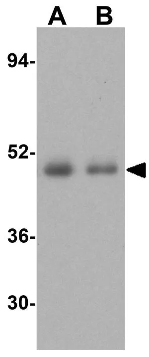 WB analysis of (A) human spleen tissue and (B) human thymus lysate using GTX31700 Caspase 5 antibody. Working concentration : 1 microg/ml WB analysis of (A) human spleen tissue and (B) human thymus lysate using GTX31700 Caspase 5 antibody. Working concentration : 1 microg/ml