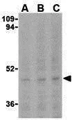 WB analysis of Ramos cell lysate using GTX31700 Caspase 5 antibody. Working concentration : (A) 0.5, (B) 1, and (C) 2 microg/ml