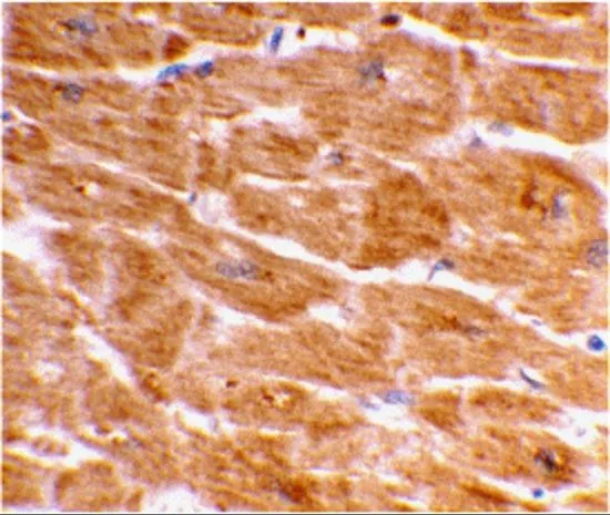 IHC-P analysis of human heart tissue using GTX31702 Caspase 1 antibody. Working concentration : 2 microg/ml
