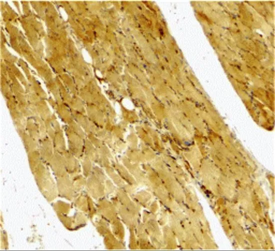 IHC-P analysis of human skeletal muscle tissue using GTX31704 Caspase 7 antibody. Working concentration : 2 microg/ml IHC-P analysis of human skeletal muscle tissue using GTX31704 Caspase 7 antibody. Working concentration : 2 microg/ml