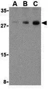 WB analysis of human skeletal muscle cell lysate using GTX31704 Caspase 7 antibody. Working concentration : (A) 0.5, (B) 1, and (C) 2 microg/ml