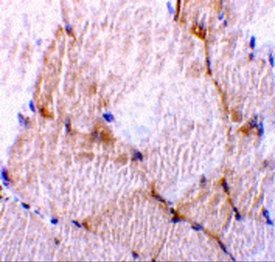 IHC-P analysis of rat skeletal muscle tissue using GTX31705 Caspase 7 antibody. Working concentration : 10 microg/ml IHC-P analysis of rat skeletal muscle tissue using GTX31705 Caspase 7 antibody. Working concentration : 10 microg/ml
