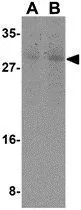 WB analysis of mouse skeletal muscle tissue lysate using GTX31705 Caspase 7 antibody. Working concentration : (A) 0.5 and (B) 1 microg/ml