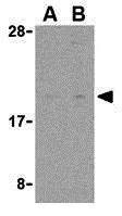 WB analysis of rat heart tissue lysate using GTX31712 Rheb antibody. Working concentration : (A) 2 and (B) 4 microg/ml WB analysis of rat heart tissue lysate using GTX31712 Rheb antibody. Working concentration : (A) 2 and (B) 4 microg/ml