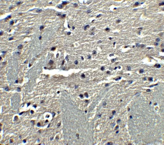 IHC-P analysis of mouse brain tissue using GTX31718 Adiponectin antibody. Working concentration : 5 microg/ml IHC-P analysis of mouse brain tissue using GTX31718 Adiponectin antibody. Working concentration : 5 microg/ml