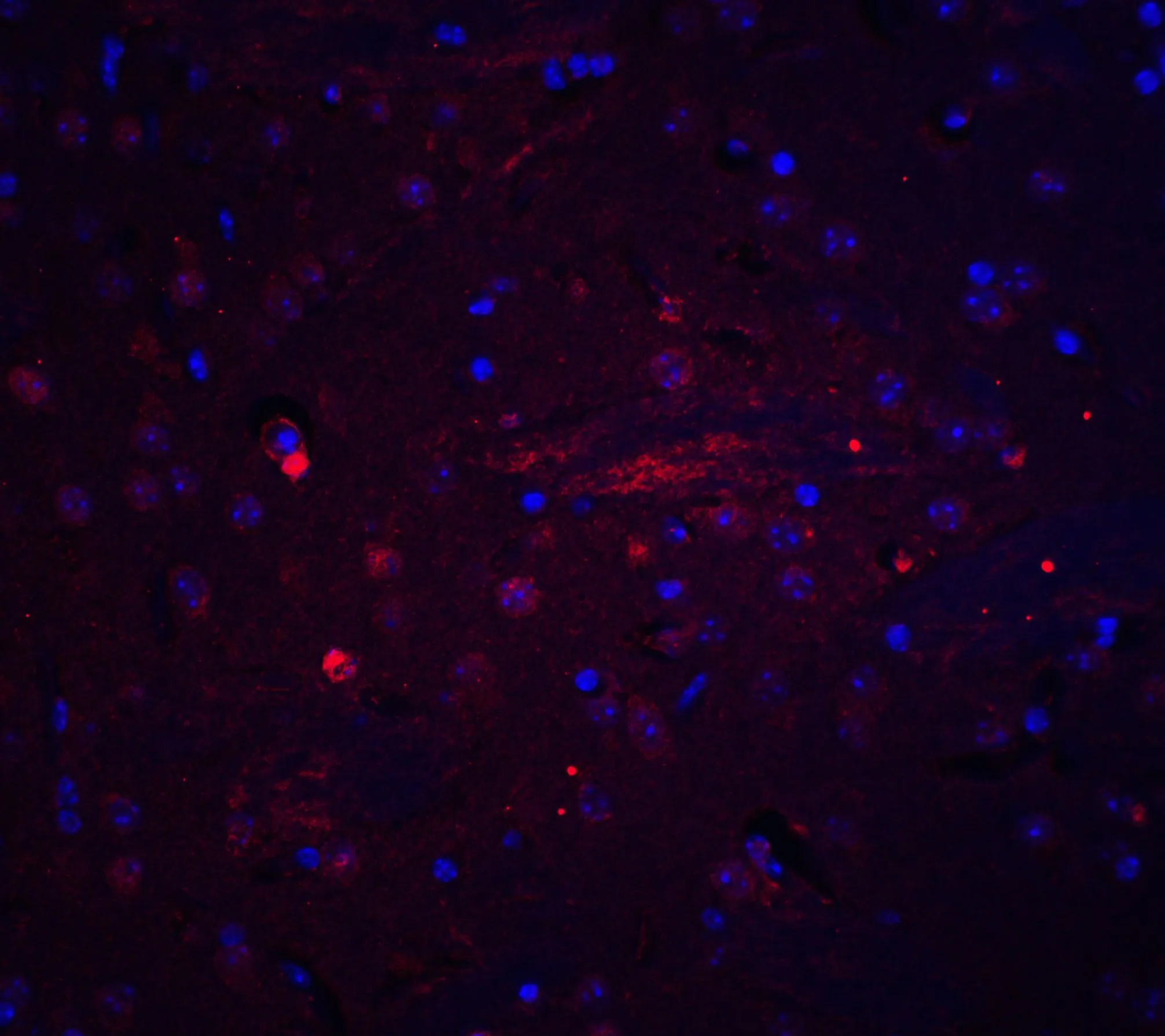 IHC-P analysis of mouse brain tissue using GTX31718 Adiponectin antibody. Red : Primary antibody Blue : DAPI Dilution : 20 microg/ml