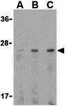 WB analysis of HL-60 cell lysate using GTX31718 Adiponectin antibody. Working concentration : (A) 0.5, (B) 1, and (C) 2 microg/ml