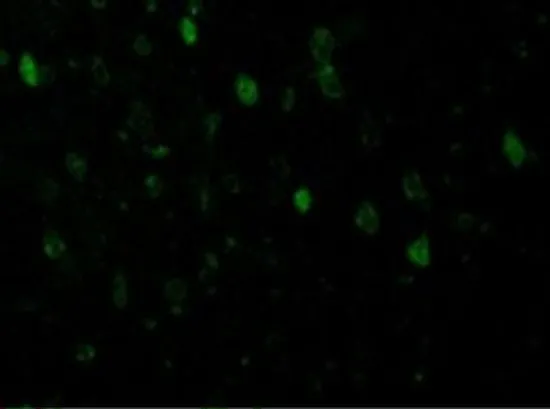 IHC-P analysis of rat brain tissue using GTX31718 Adiponectin antibody. Working concentration : 10 microg/ml