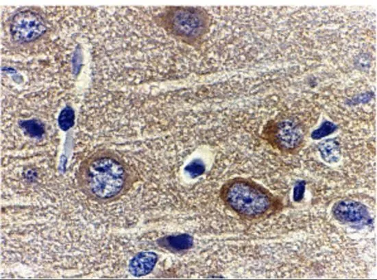 IHC-P analysis of rat brain tissue using GTX31719 Adiponectin antibody. Working concentration : 1 microg/ml IHC-P analysis of rat brain tissue using GTX31719 Adiponectin antibody. Working concentration : 1 microg/ml
