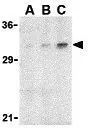 WB analysis of rat brain tissue lysate using GTX31719 Adiponectin antibody. Working concentration : (A) 1, (B) 2, and (C) 4 microg/ml