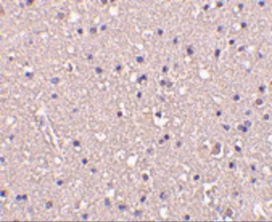 IHC-P analysis of human brain tissue using GTX31723 CRMP1 antibody. Working concentration : 10 microg/ml IHC-P analysis of human brain tissue using GTX31723 CRMP1 antibody. Working concentration : 10 microg/ml
