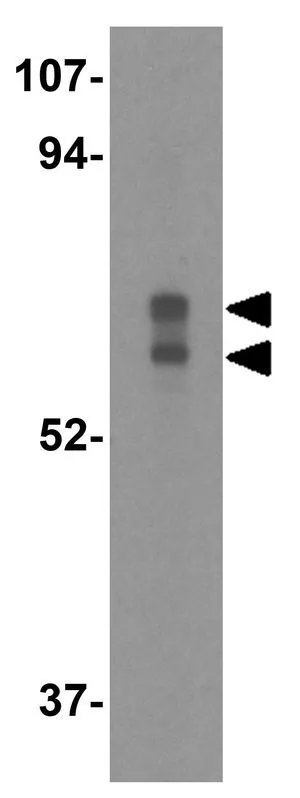WB analysis of Caco-2 cell lysate using GTX31723 CRMP1 antibody. Working concentration : 0.5 microg/ml