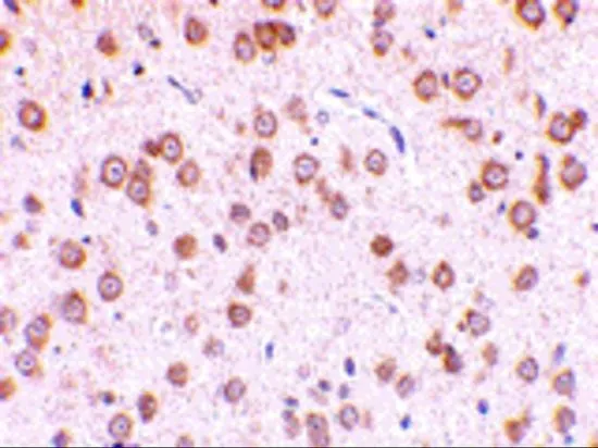 IHC-P analysis of rat brain tissue using GTX31724 TLR5 antibody. Working concentration : 10 microg/ml IHC-P analysis of rat brain tissue using GTX31724 TLR5 antibody. Working concentration : 10 microg/ml