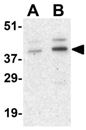 WB analysis of human bladder tissue lysate using GTX31735 Cyclin O antibody. Working concentration : (A) 1 and (B) 2 microg/ml WB analysis of human bladder tissue lysate using GTX31735 Cyclin O antibody. Working concentration : (A) 1 and (B) 2 microg/ml