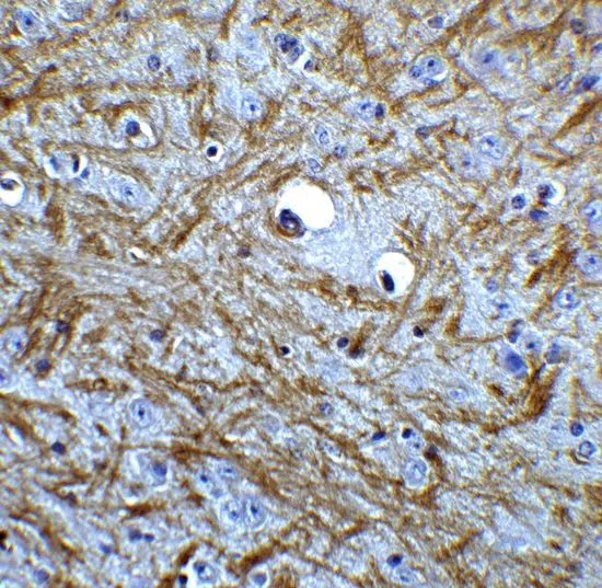 IHC-P analysis of mouse brain tissue using GTX31736 Bag1 antibody. Working concentration : 5 microg/ml IHC-P analysis of mouse brain tissue using GTX31736 Bag1 antibody. Working concentration : 5 microg/ml