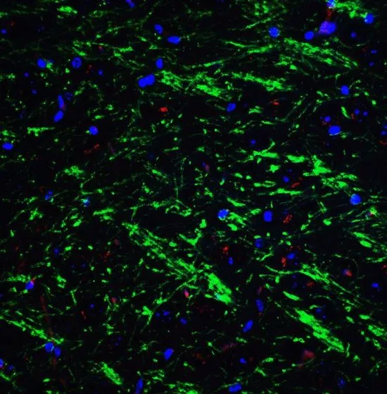 IHC-P analysis of mouse brain tissue using GTX31736 Bag1 antibody. Working concentration : 20 microg/ml Green : Primary antibody Blue : DAPI Red : Actin